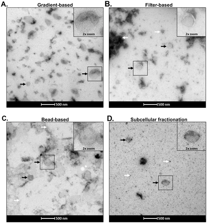 Anal. Chem. 2026, 98, 6, 4585–4600: Figure 2. Transmission electron microscopy (TEM) of isolated fractions. Panels A–D show TEM images of the four isolated fractions. Insets display magnified views of the regions outlined in black squares. Black arrows indicate identified representative isolated vesicles, and white arrows denote areas of contamination.