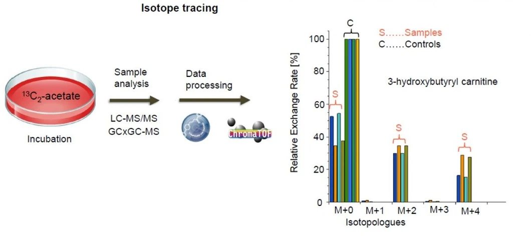 BIOCEV: Introducing BIOCEV OMICS Mass Spectrometry Core Facility - Untargeted metabolomics Fig. 1.
