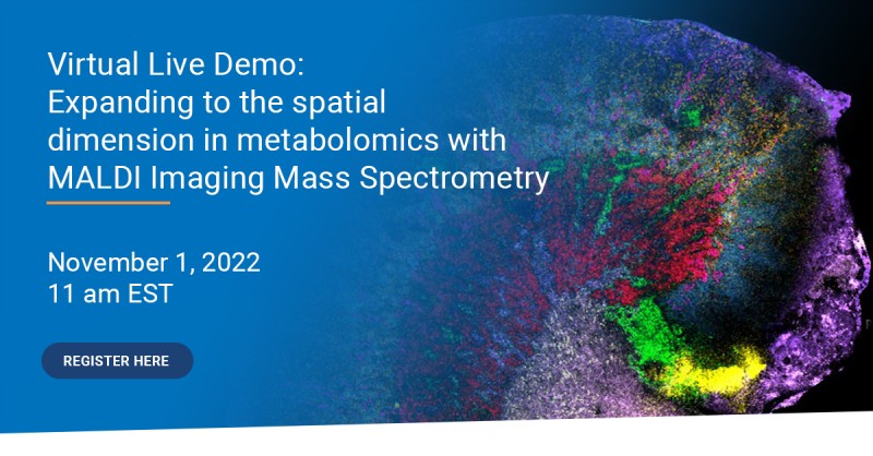 Bruker: Expanding to the spatial dimension in metabolomics with MALDI Imaging Mass Spectrometry