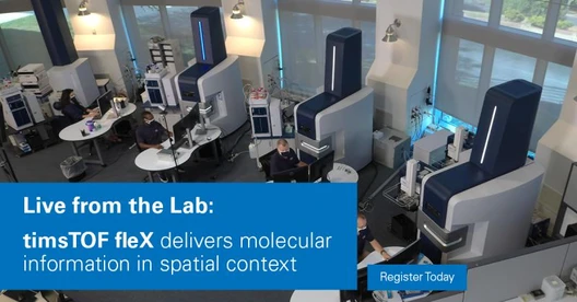 Mass Spectrometry Imaging Using Bruker timsTOF fleX with MALDI 2