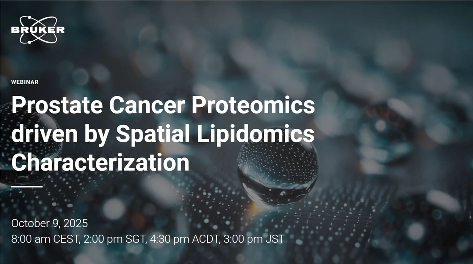 Bruker: Prostate Cancer Proteomics driven by Spatial Lipidomics Characterization