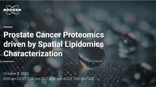 Prostate Cancer Proteomics driven by Spatial Lipidomics Characterization