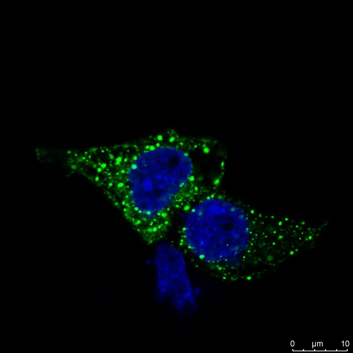 CEITEC/Tripsianes Lab: Scientists Uncover a Tipping Point in Cells. This Is How Cancer May Begin: DVL in a cell (green), cell nucleus (blue)