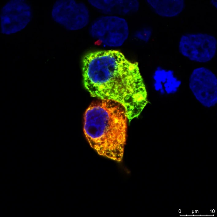 CEITEC/Tripsianes Lab: Scientists Uncover a Tipping Point in Cells. This Is How Cancer May Begin: DVL in a cell (green), enzym modifiyng DVL (red), cell nucleus (blue)