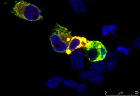  Scientists Uncover a Tipping Point in Cells. This Is How Cancer May Begin 