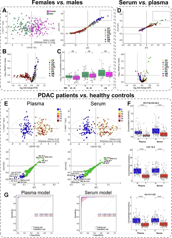 Commun Med 6, 127 (2026): Fig. 2: Comparison of lipid profiles obtained by UHPSFC/MS for following group pairs: females vs. males (plasma model), serum vs. plasma (female models), and PDAC patients vs. healthy controls (male models). A Score plots of orthogonal partial least squares discriminant analysis (OPLS-DA) and the corresponding S-plots highlighting the most dysregulated lipid species. B Volcano plot showing the most dysregulated lipid species based on log2-transformed fold changes and −log10 p-values (two-sided t-test). C Relation between body mass index (BMI) and the sum of triacylglycerols (TG), where significance is determined by the Mann–Whitney U test; p-values > 0.05 correspond to non-significant (ns). BMI categories: 20–25 (22 males and 49 females), 25–30 (47 males and 46 females), and >30 (24 males and 25 females). D Visualization of differences between serum and plasma samples using multivariate and univariate approaches. S-plot is generated from OPLS-DA highlighting the contribution of individual lipid species to group separation. Volcano plot showing log2-transformed fold changes and −log10 p-values (two-sided t-test). E Supervised OPLS-DA score plots with cancer samples colored according to tumor stage (T1—yellow, T2—orange, T3—red, T4—rose, and Tx—brown, where information about the stage is not available), and the corresponding S-plots indicate the most upregulated (red) and downregulated (blue) lipid species for plasma and serum models. F Box plots of the most dysregulated lipid species showing differences in concentrations between healthy controls (N, blue; n = 93) and PDAC patients (T, red; n = 88). The number of significance symbols corresponds to p-value ranges from the Mann–Whitney U test; p < 0.0001 is indicated by ****. G Receiver operating characteristic (ROC) curves with the 95% confidence intervals for plasma and serum models in training and validation sets, combining male and female data (prediction scores derived from gender-specific models).