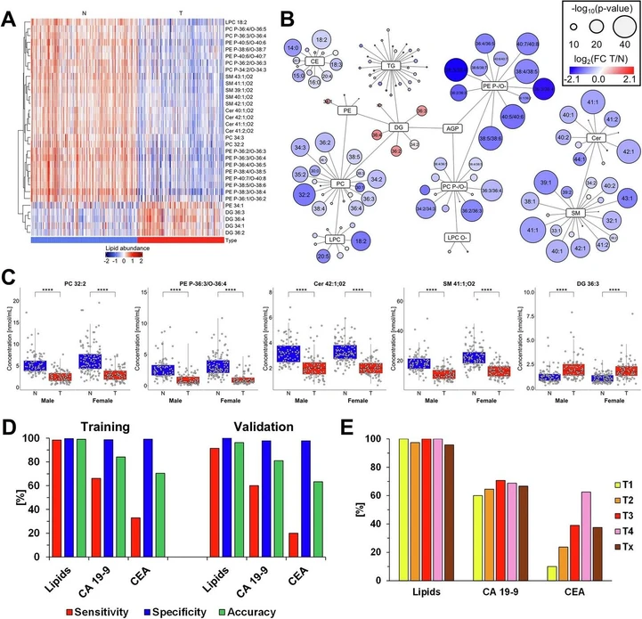 Commun Med 6, 127 (2026): Fig. 3 Plasma lipidomic alterations in PDAC. Results of the lipidomic profiling of PDAC patients (T, tumor) and healthy controls (N, normal) using plasma models. A Heatmap of the most dysregulated lipids, showing the concentrations of lipid species across individual samples. B Network mapping of lipid species, where the size of each circle reflects p-values (two-sided t-test) for individual lipids, and red/blue color saturation represents fold change (T/N). C Box plots of the most dysregulated lipid species visualizing differences in concentrations between PDAC patients (T, red) and healthy controls (N, blue). The number of significance symbols corresponds to p-value ranges from the Mann–Whitney U test; p < 0.0001 is indicated by ****. Study groups: 93 N vs. 88 T of males and 125 N vs. 89 T of females. D Sensitivity (red), specificity (blue), and accuracy (green) based on predictions using the lipidomic profiling method (lipids), carbohydrate antigen 19-9 (CA 19-9), and carcinoembryonic antigen (CEA) in the training and validation sets. E Sensitivity of individual methods according to tumor stages (T1—yellow, T2—orange, T3—red, T4—rose, and Tx—brown, where information about the stage is not available) for the lipidomic profiling method (Lipids), CA 19-9, and CEA in the training set.