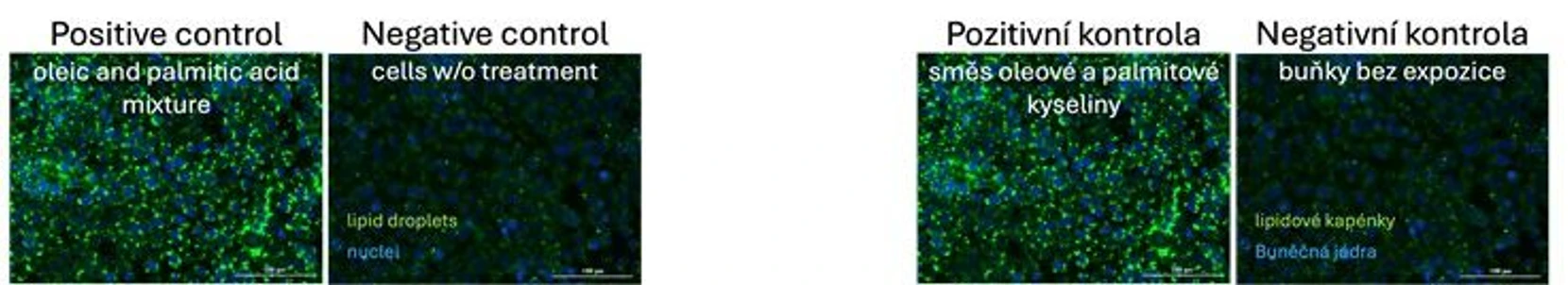 RECETOX: Example of the studied parameter, in this case, hypertrophy of Leydig cells